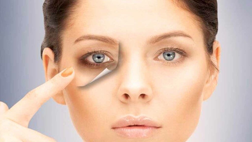 how to get rid of dark circles